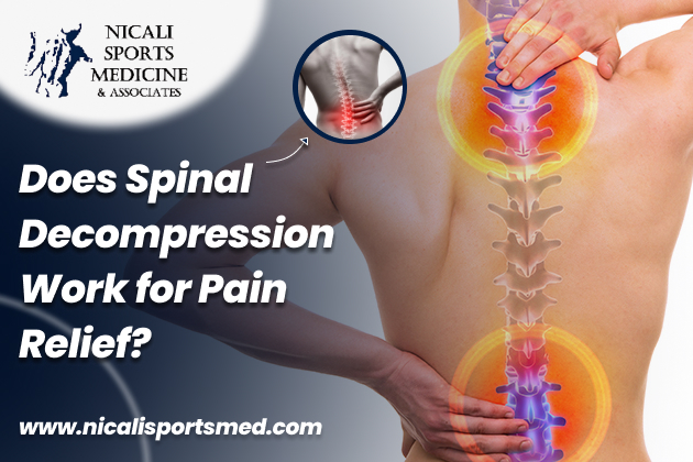 Does Spinal Decompression therapy Work for Pain Relief?