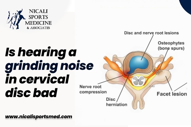 is hearing a grinding noise in cervical disc bad